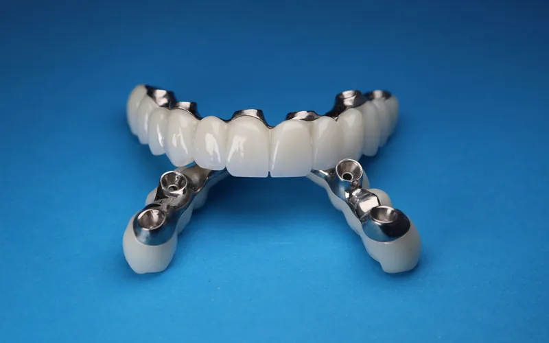 Prótesis fija de arcada completa sobre implantes tipo All-on-4, con sus conexiones de titanio