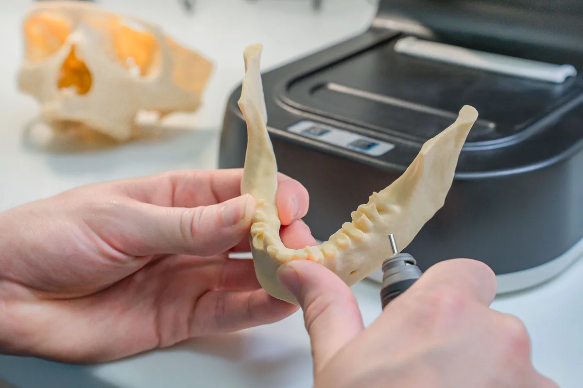 Técnico repasando un modelo de mandíbula impreso en 3D para planificar la carga inmediata