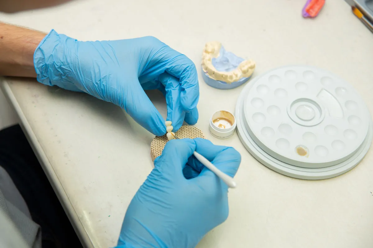 Técnico dental estratificando cerámica con pincel para fabricar carillas dentales en el laboratorio