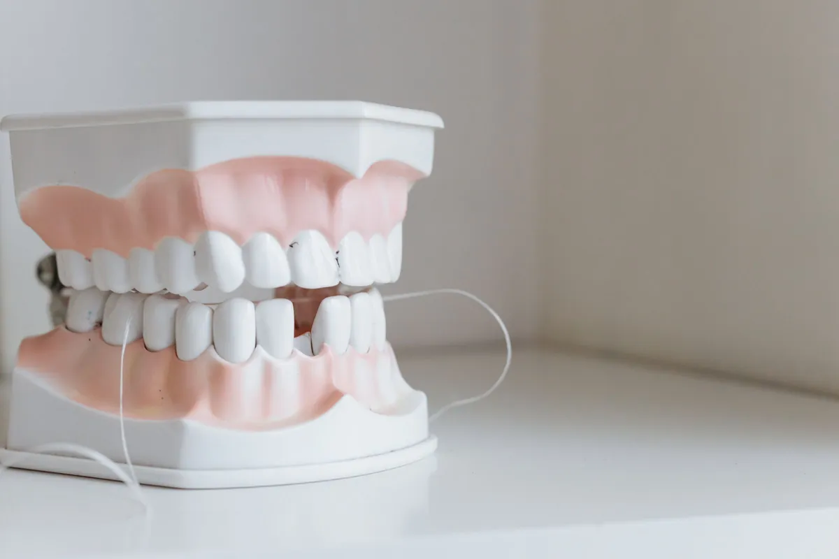 Hilo dental entre los dientes de un modelo, parte de la limpieza diaria de una corona sobre implante