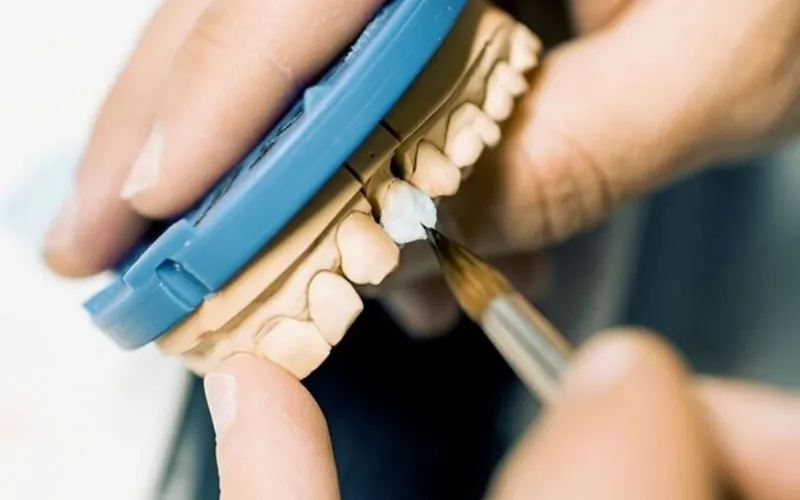 Técnico dental maquillando con pincel unas coronas dentales de cerámica sobre el modelo