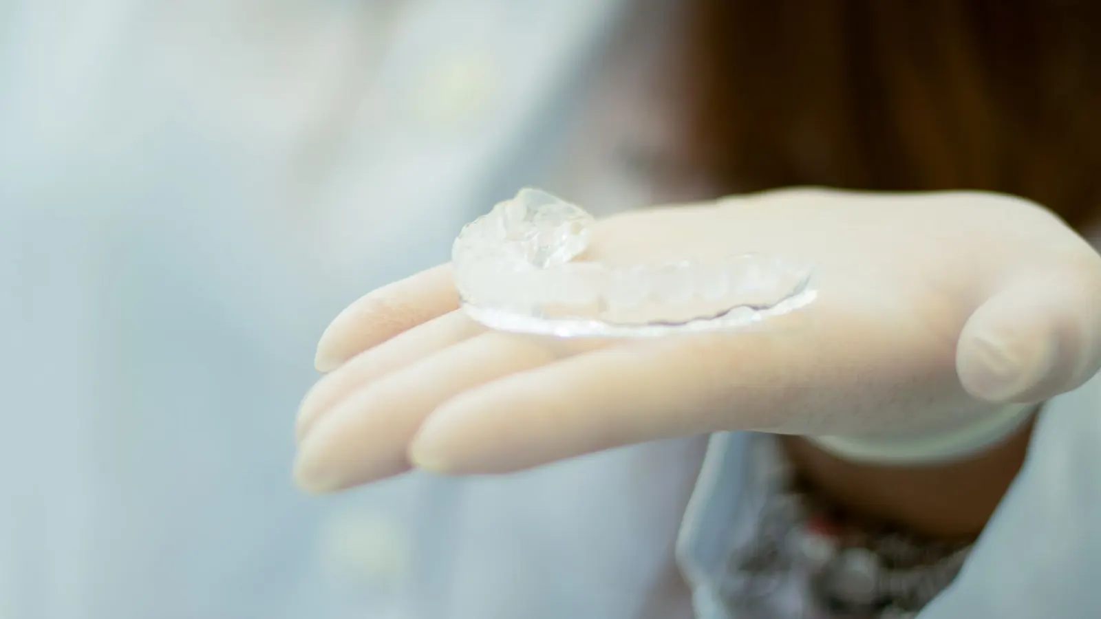Férula de descarga transparente para el bruxismo sostenida con guantes en la clínica dental