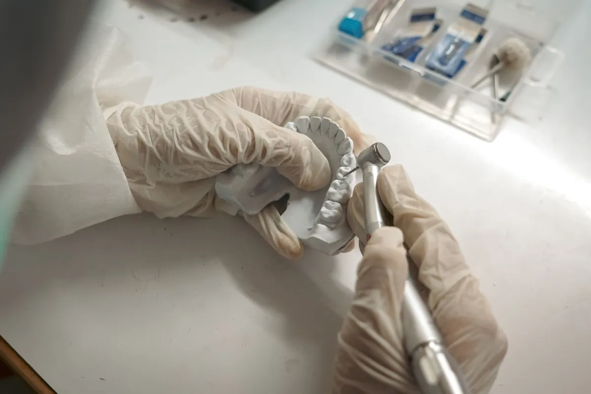 Técnico dental trabajando con la fresa sobre un modelo durante la fabricación de una incrustación dental