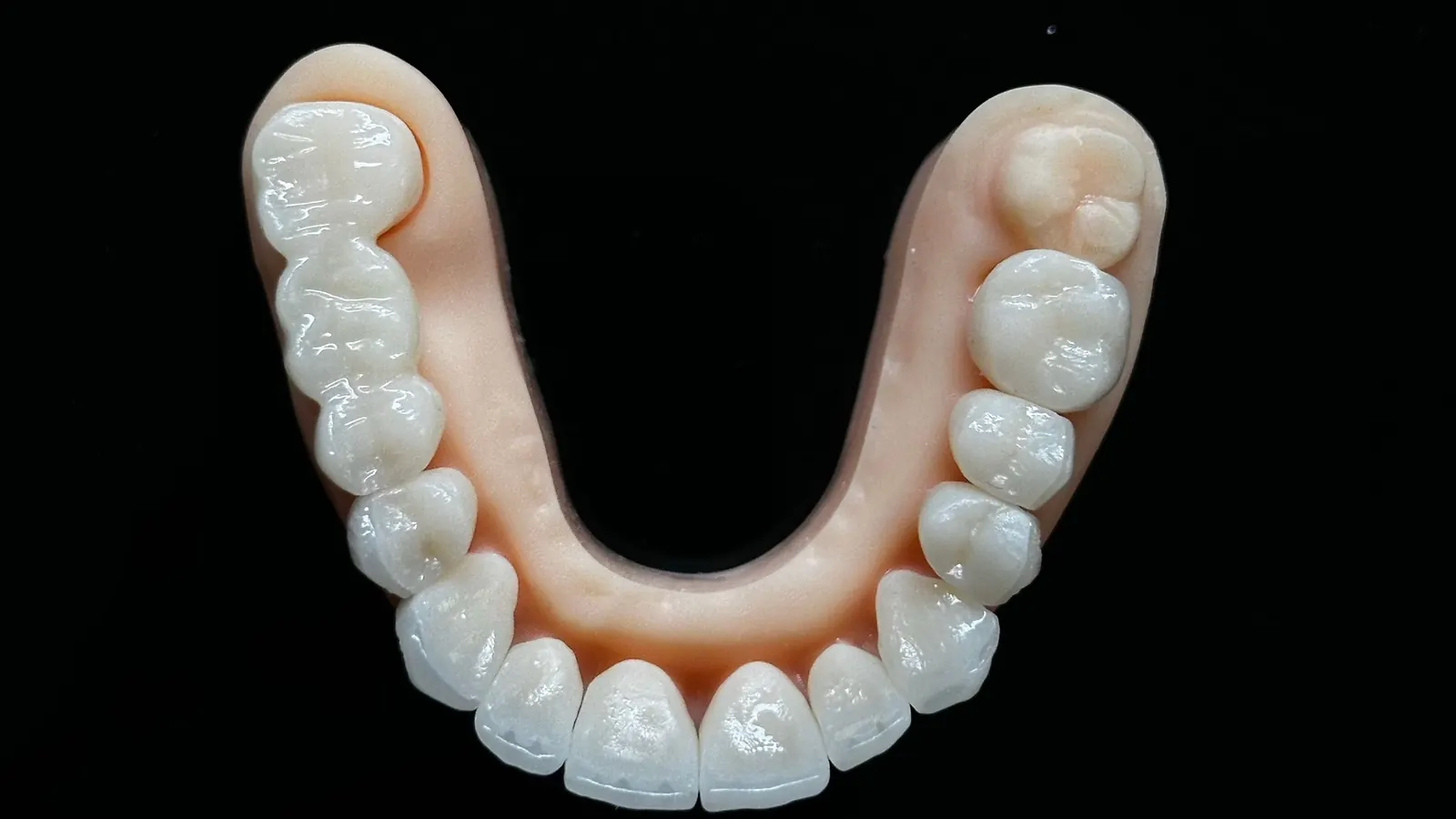 Prótesis dental de zirconio de arcada completa con encía rosada sobre fondo negro