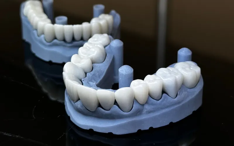 Prótesis provisionales de arcada completa sobre modelos impresos en 3D