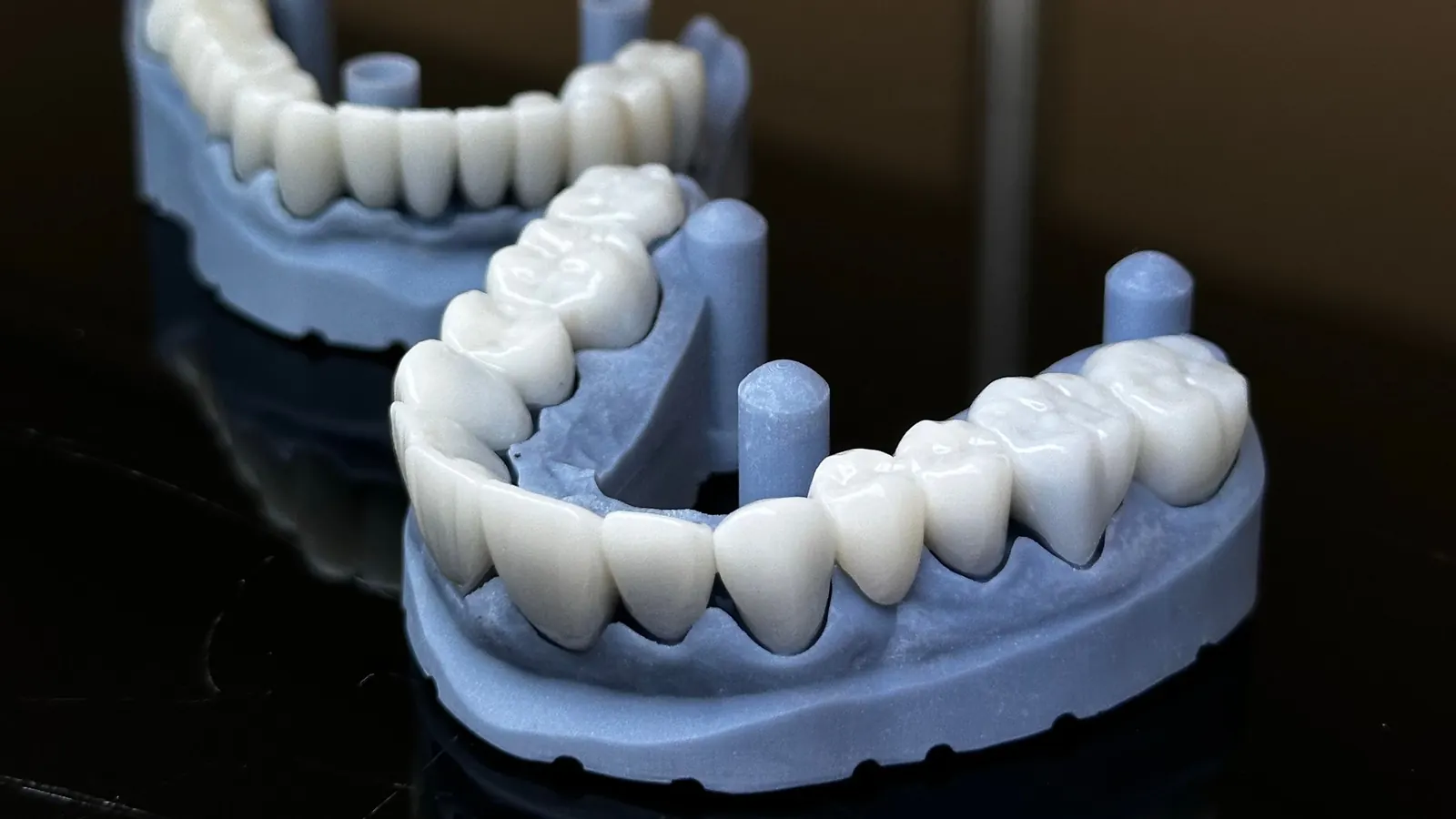 Prótesis provisionales de arcada completa sobre modelos impresos en 3D