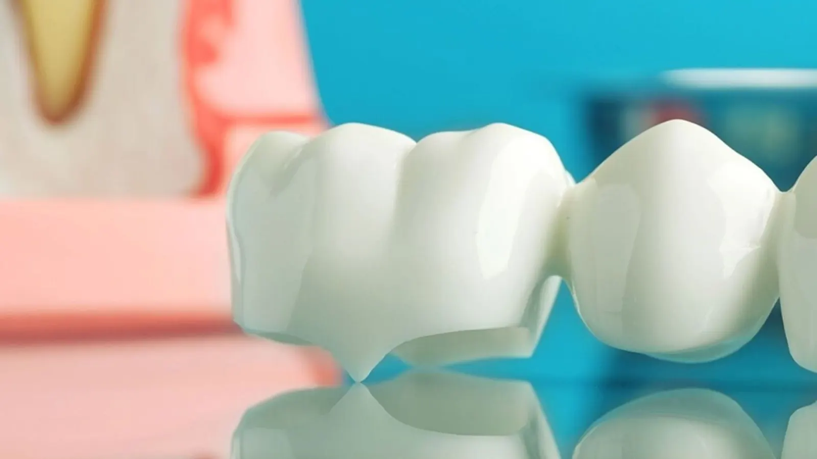 Puente dental de cerámica de varias piezas junto a un modelo anatómico de diente