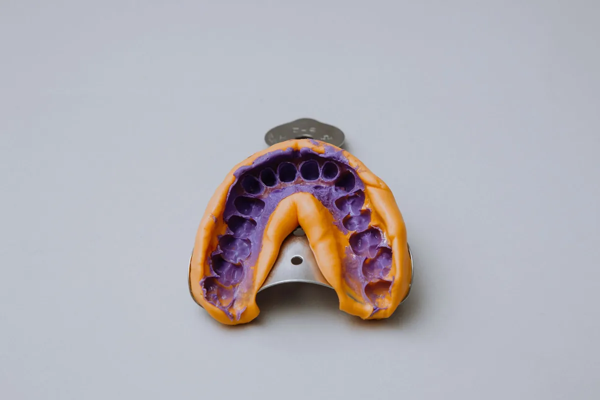 Impresión dental en cubeta que registra la forma actual de la boca, primer paso de un rebase de prótesis