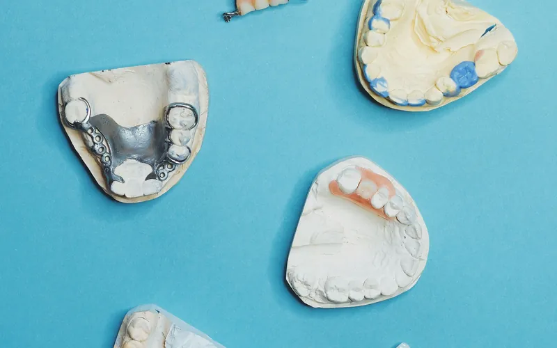 Distintos tipos de prótesis dentales sobre modelos de escayola junto a una guía de color