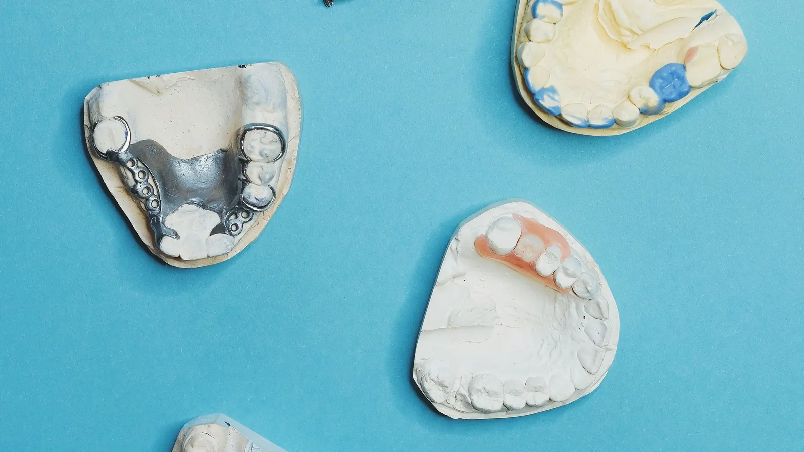 Distintos tipos de prótesis dentales sobre modelos de escayola junto a una guía de color