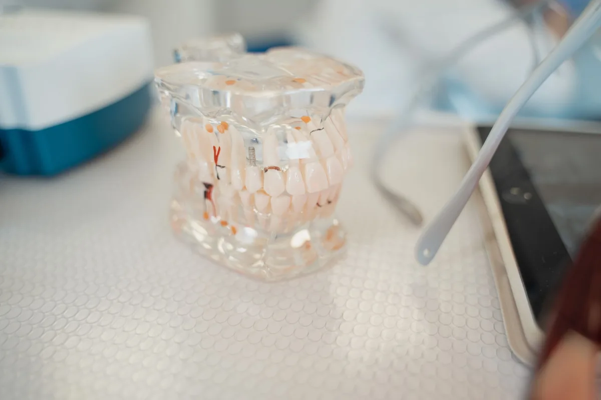 Maqueta dental transparente que deja ver las raíces de los dientes y el espacio entre ellas