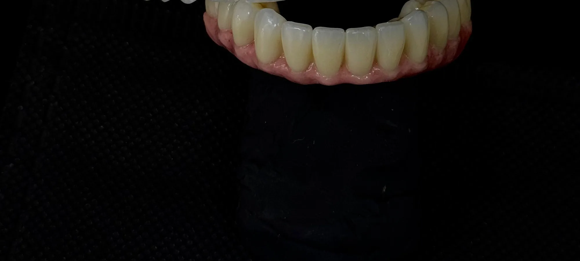 Prótesis completa terminada en Plano Dentalab