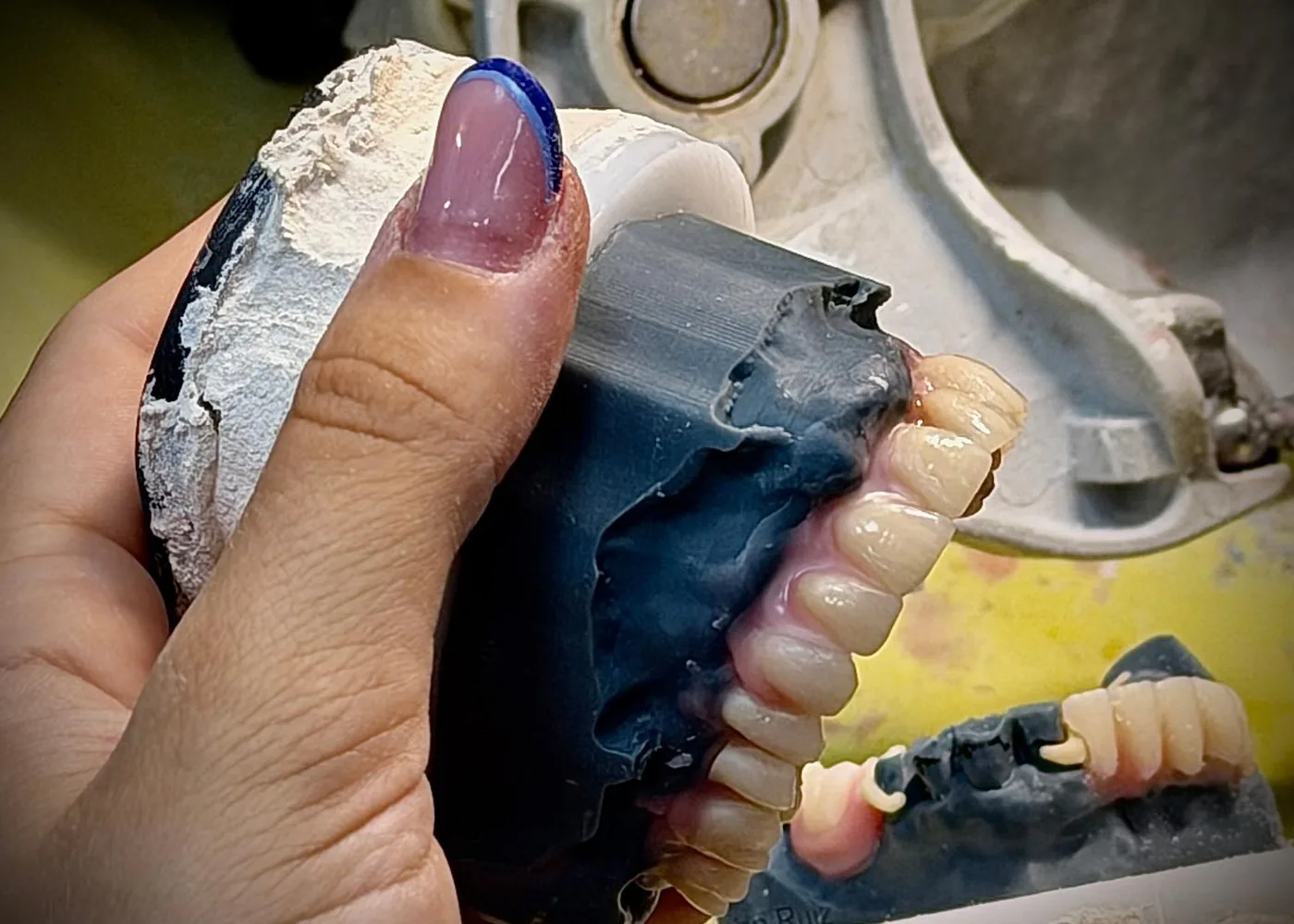 El equipo técnico de PlanoDentaLab comprobando una prótesis completa sobre el modelo